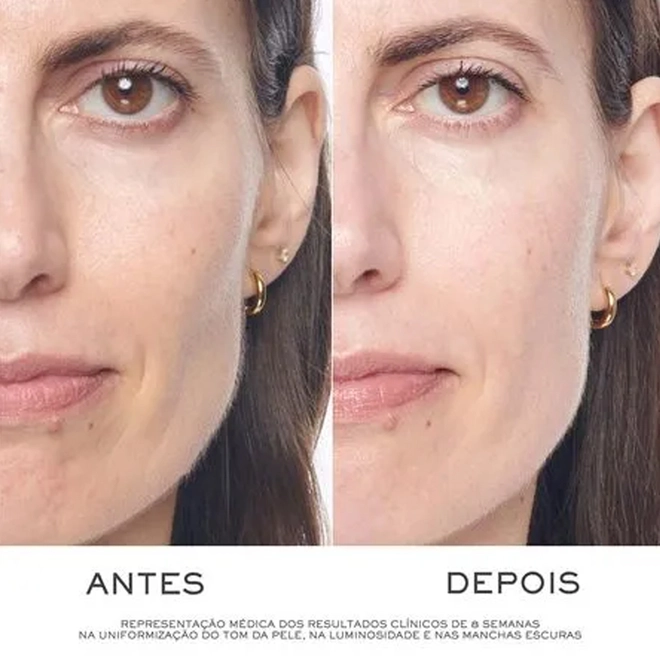 kit serum lancome renergie triple serum 50 ml + miniaturas